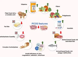 PCOS Home Remedies