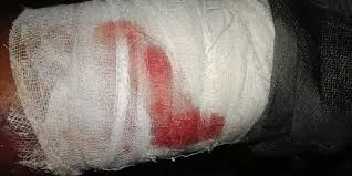 Muzaffarpur Youth Shot Dead