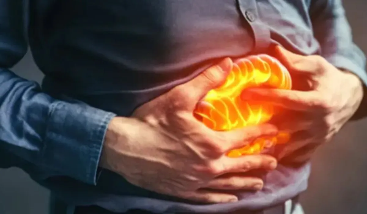 Home Remedies for Acidity